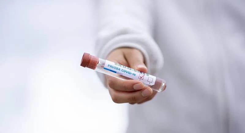 Tri nova slučaja koronavirusa u Nikšiću, aktivno 28