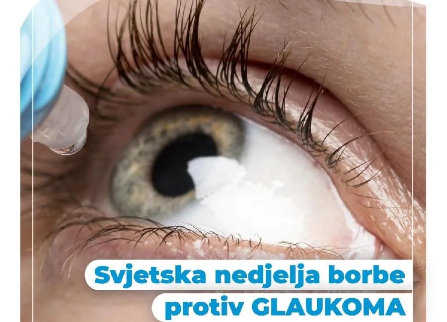 Pregledi bez uputa u oftalmološkoj klinici 16. i 17. marta