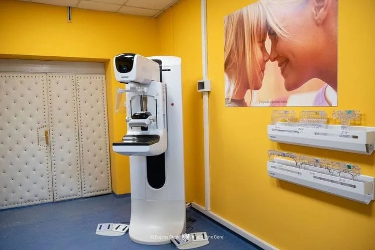 Šimun: Nikšićka bolnica prva u Crnoj Gori, pored KCCG, sa mamografom nove generacije