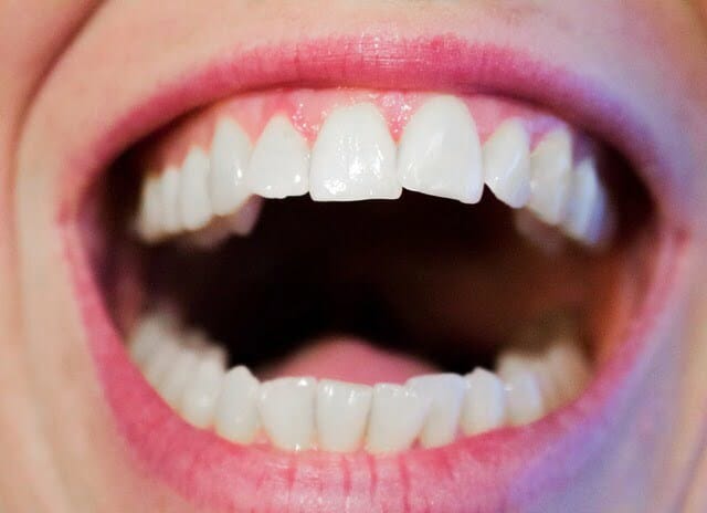 teeth-1652937_640