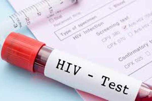 hiv