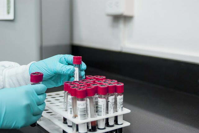 lab-gad44e7dae_640